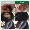 Natural Rosemary Hair Growth Essential Oil S8a99858a388a4929930dd8fe7ffc9938C 12ab542d