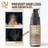 Hair Growth Spray New PURC Hot sale Growth Hair Essence Oil Prevent Hair Loss Spray Help for hair Growth 3 283cbfaf