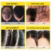 Rosemary & Ginger Oil Anti-Dandruff Hair Growth Cream S8d5399f682664b44b000818508d98aaby 301106f3