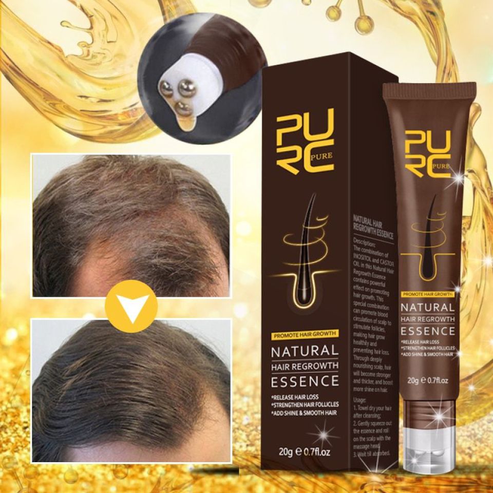 PURC Natural Hair Regrowth Essence & Hair Density Essential Oil Set H5d938a987b954105b932f663e202d576q 39069422