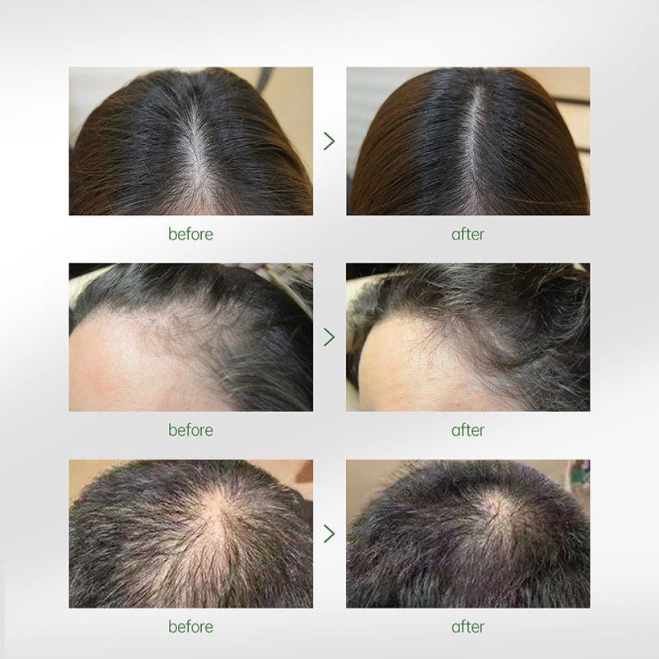PURC Intensive Hair Strengthening Treatment Serum S0fd35152909e439dae5d2f1e5a5d3af9g 3eabed60