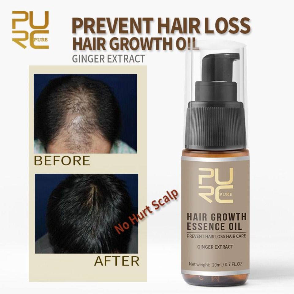 PURC Hair Growth Spray New PURC Hot sale Growth Hair Essence Oil Prevent Hair Loss Spray Help for hair Growth 3 3fcf8d25