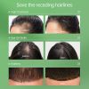 PURC Intensive Hair Strengthening Treatment Serum Sa5d4bf9c178a48e4bb6b50ea5d3d646dW 40c8a2fa