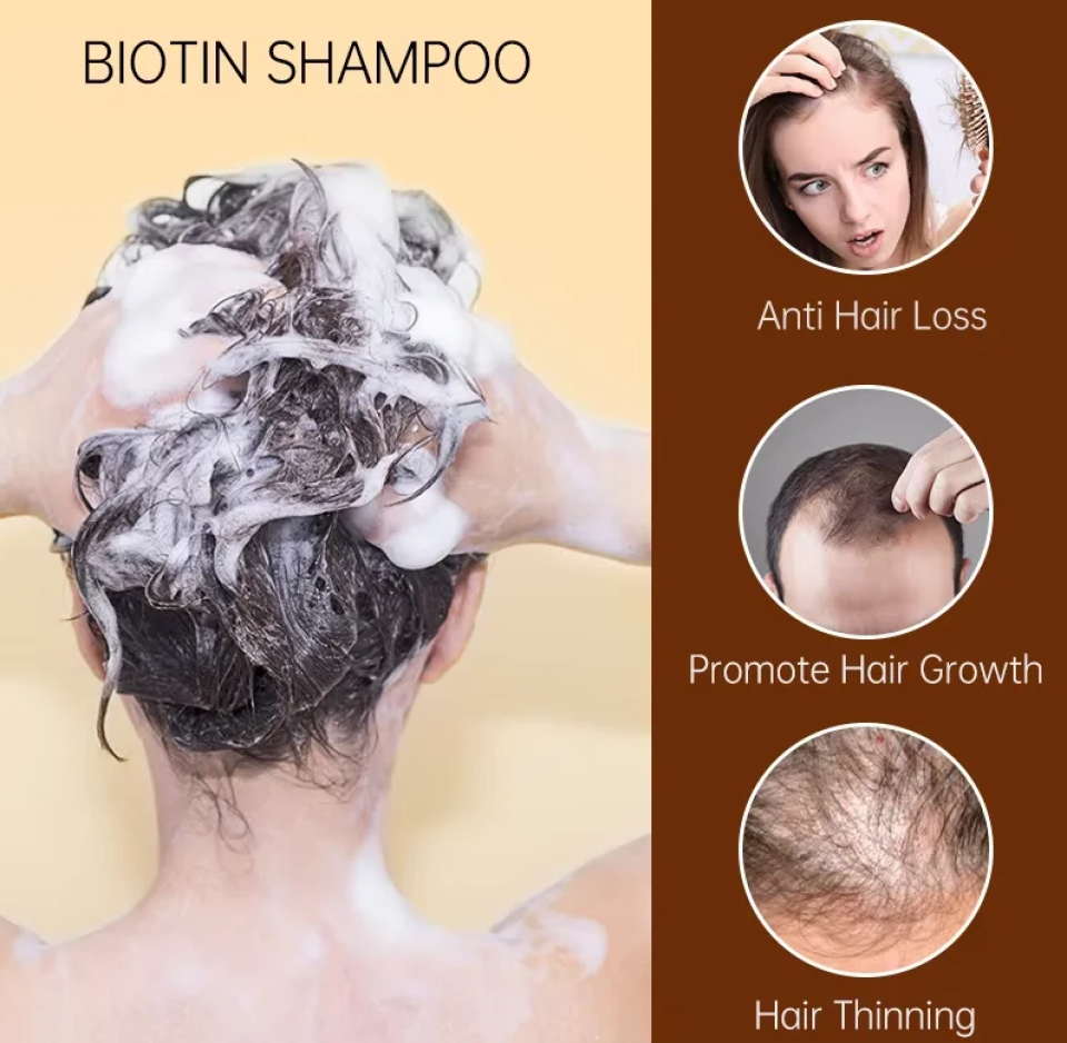 Biotin and Ginger Hair Growth Oil Shampoo Conditioner Sets be105d43 bb4b 4454 aaf9 a246dd44531c506137 1 449a0c2a