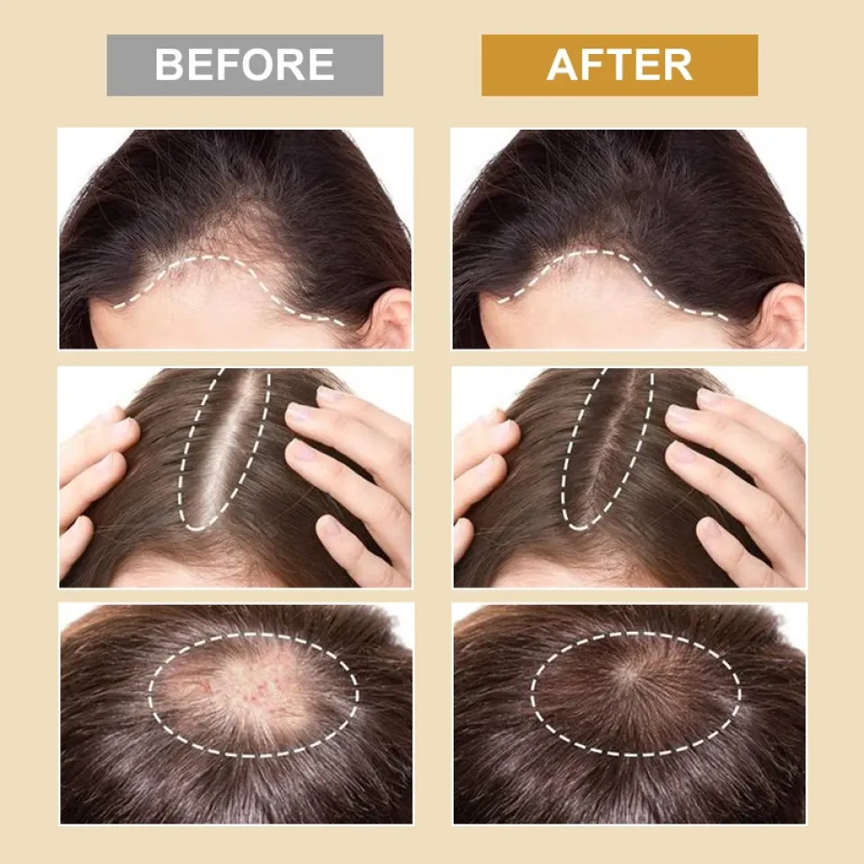 PURC Biotin Anti-Loss & Repair Hair Mask S20a5a5d487ac4f18a2b70992854c3a2au 1 4527ea90
