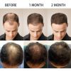 Fast Hair Growth Ginger Essence Oil PURC Hot sale Fast Hair Growth Essence Oil Hair Loss Treatment Help for hair Growth Hair 2 508db74b