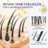 Anti Hairfall Hair Growth Spray Safdb8f7a196b4e1b92c898debbf919e46 1 51ed8af4