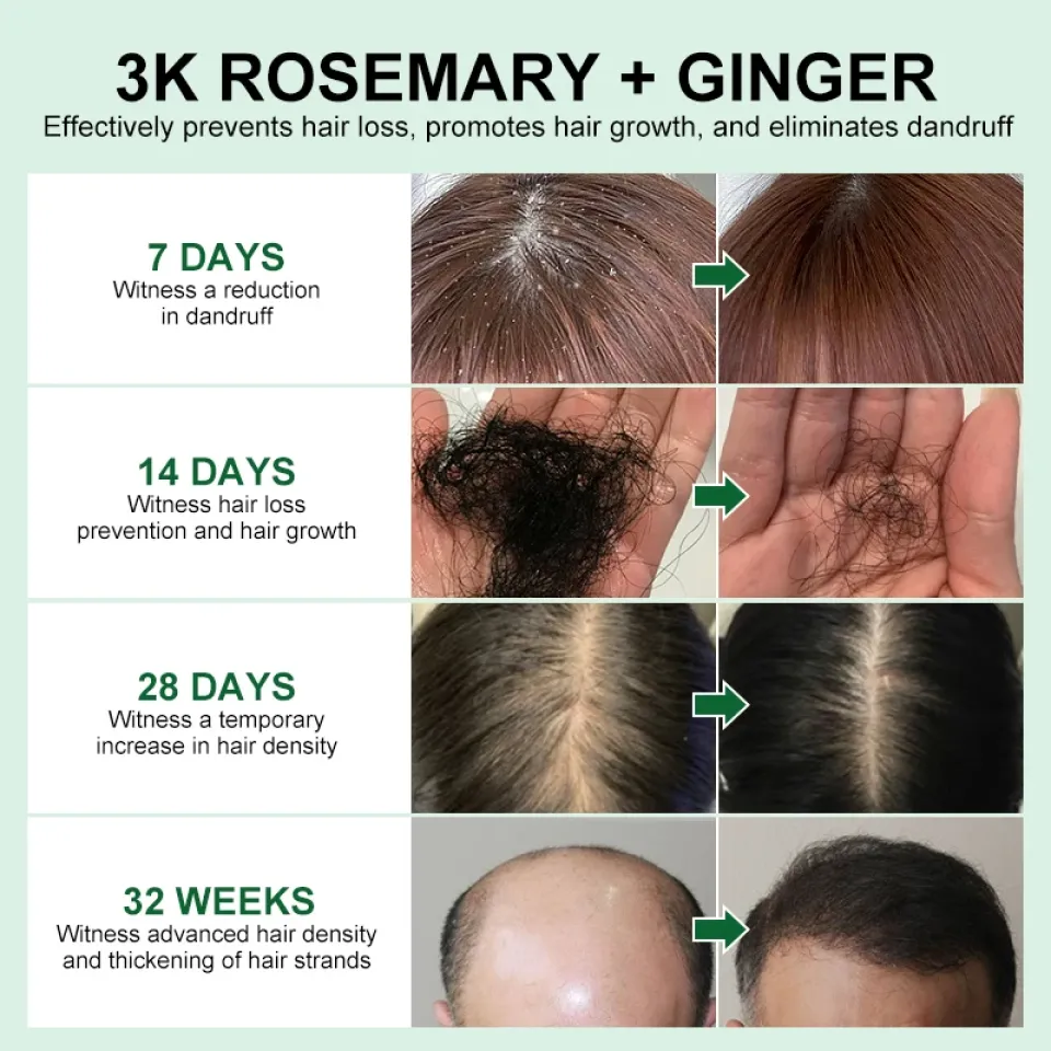 PURC Natural Rosemary Hair Growth Essential Oil S3ddcd8c67437456a8a2e47d67c9b211cy 57bb3976