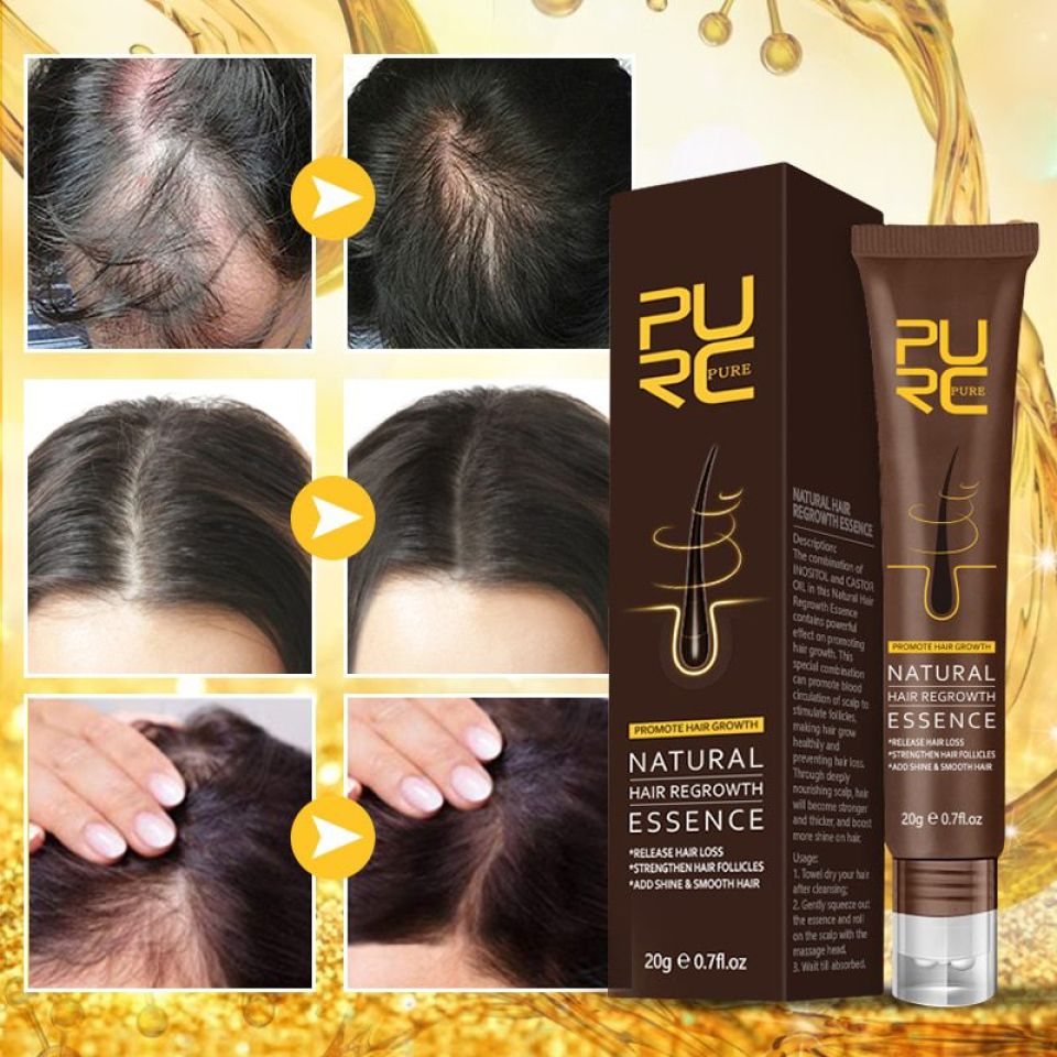 PURC Natural Hair Regrowth Essence & Hair Density Essential Oil Combo Hcb8b683faf3d4bad922a2a35fbccd6b4s 5a67760a