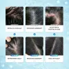 Anti-Dandruff Scalp Treatment Gel H1297209902aa47b7ad65833691c18658W 62824eab