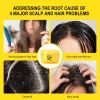 Rosemary & Ginger Oil Anti-Dandruff Hair Growth Cream S143b1c1cf60a4d6db70d6a7b7d4c1b14z 67014be4