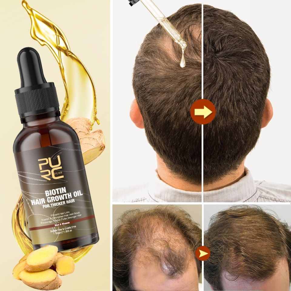 Biotin Shampoo, Conditioner & Oil Combo Sb8c533f106ea459c9badd1282dc0216a1 1 735b6b2f