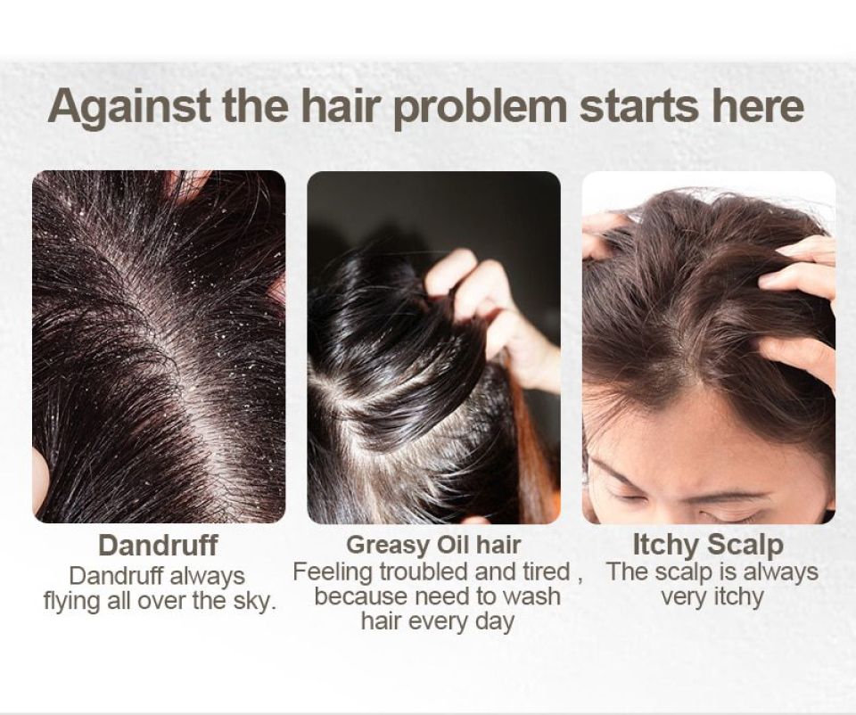 The Original Series PURC Shampoo Bar - Set Of 7 7 types PURC Organic shampoo soap Vegan handmade cold processed refreshing antidandruff hair shampoo Big Sale 3 8047302d