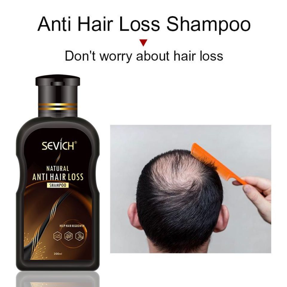 Sevich Hair Loss Treatment Herbal Shampoo sevich 200ml hair loss treatment shampoo hair care shampoo bar ginger hair growth cinnamon anti hair 2 84f9fa61