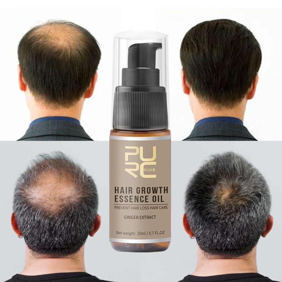 Hair Growth Spray, PURC Hair Growth Oil