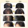 Anti Hair Loss & Hair Growth Serum S3986ed18a219483aaa86099307b5d730a 8c6f9a9b