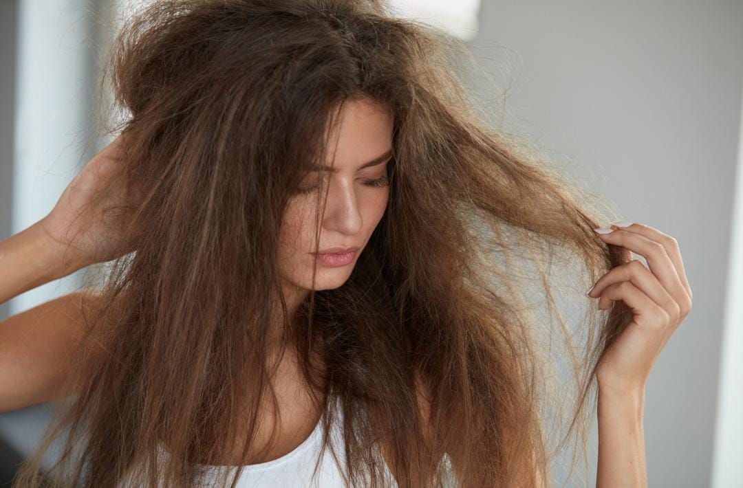 hair fall