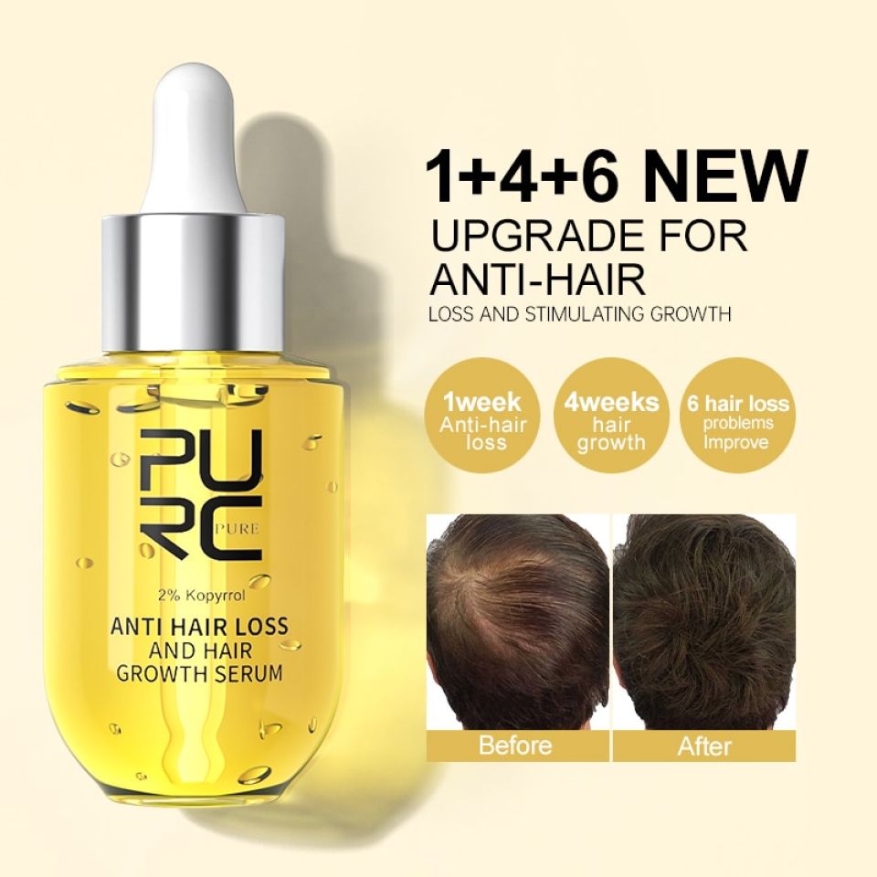 Anti Hair Loss & Hair Growth Serum Se54c4a028b724e648e8301364db4f408U 95bf5570