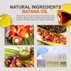 Batana Oil Hair Mask Sfad7568affa948adb8ad62b7e1b5d8c8y a172838a