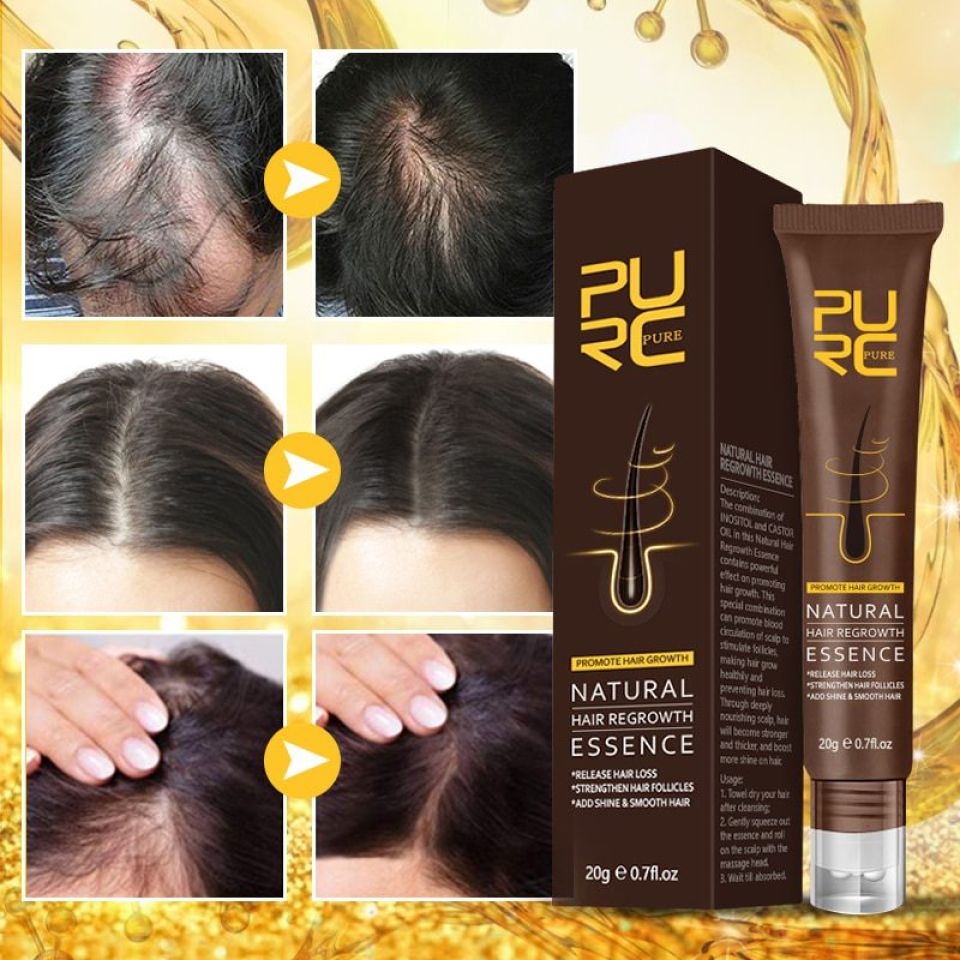 PURC Natural Hair Regrowth Essence & Hair Density Essential Oil Set Hcb8b683faf3d4bad922a2a35fbccd6b4s a7e5e191