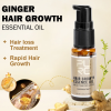 Biotin and Ginger Hair Growth Oil Shampoo Conditioner Sets f6c313ef 90b0 4d2c a4fb 7a2a5bda797a518765 1 ba41cd3c