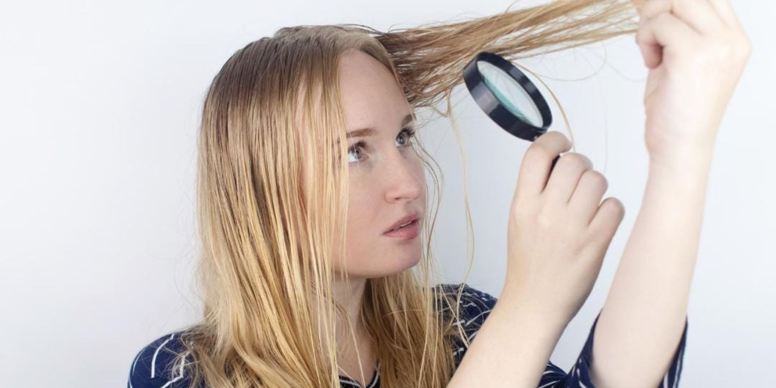 <strong>Are Oily Scalp & Oily Hair Different?</strong> WhatsApp Image 2023 04 28 at 17.01.18 bf0a771e