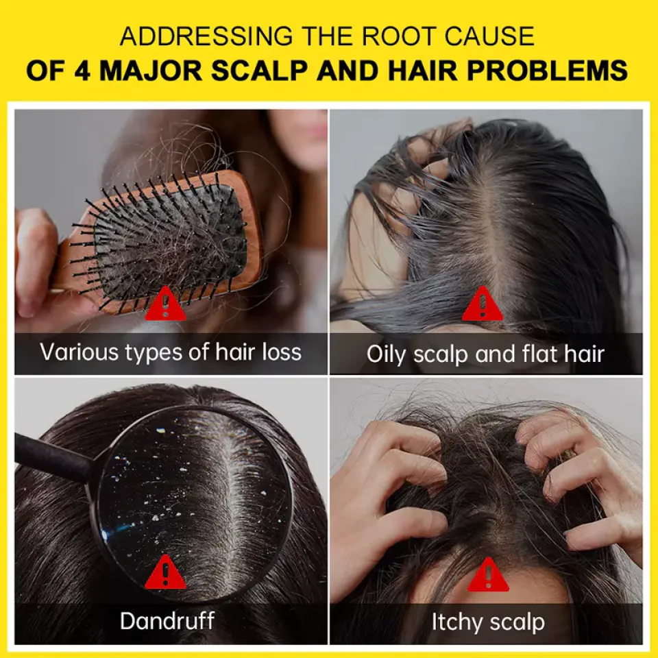 PURC Rosemary & Ginger Oil Anti-Dandruff Hair Mask purc rosemary and ginger oil anti dandruff hair mask 2 c1832f34