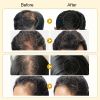 Anti Hair Loss & Hair Growth Serum S3986ed18a219483aaa86099307b5d730a c9094eae