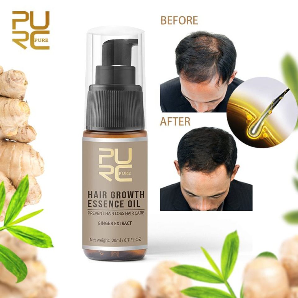 Hair Growth Spray New PURC Hot sale Growth Hair Essence Oil Prevent Hair Loss Spray Help for hair Growth 1 ca65fd18