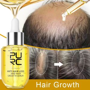 Benefits Of Adding Hair Mask To Your Hair Care Regime S5c38e1342826407a90d779fce93cfc635 cd0ccd5a