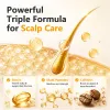 PURC Biotin & Peptide Scalp Conditioning Essence Oil Sa83ecd1bda85412ebc07ce7e111dc7c3g d1150c7c