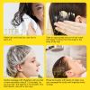 Rosemary & Ginger Oil Anti-Dandruff Hair Growth Cream Sf107282c22f3434f909fb0701530188bd ea058a5f