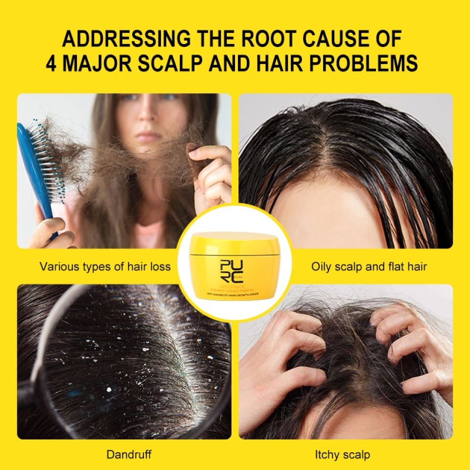 Rosemary & Ginger Oil Anti-Dandruff Hair Growth Cream S143b1c1cf60a4d6db70d6a7b7d4c1b14z ecb46e51