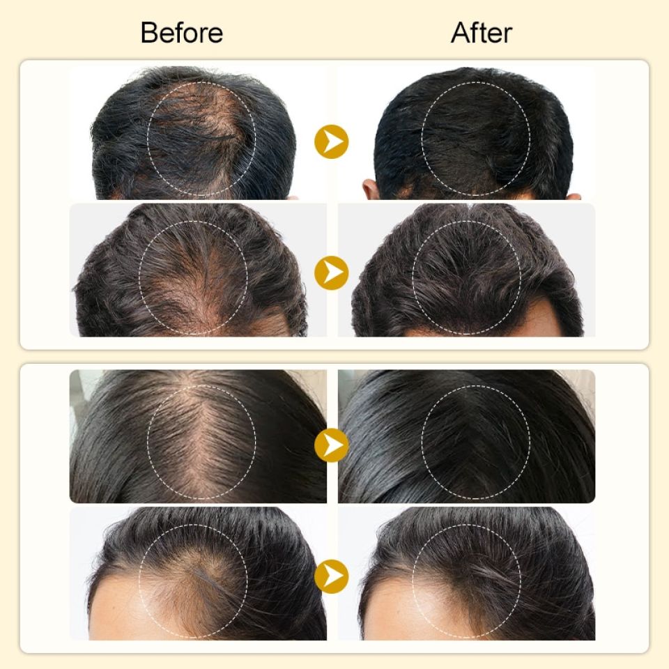 Anti Hair Loss & Hair Growth Serum S3986ed18a219483aaa86099307b5d730a ed380999