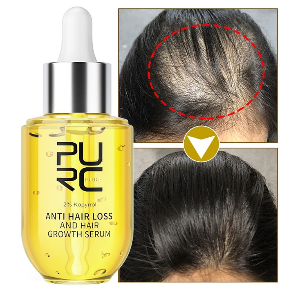 Anti Hair Loss & Hair Growth Serum Sb8f720e48f054fb594b099349bb36fb0L f4bee021