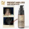 Hair Growth Spray New PURC Hot sale Growth Hair Essence Oil Prevent Hair Loss Spray Help for hair Growth 3