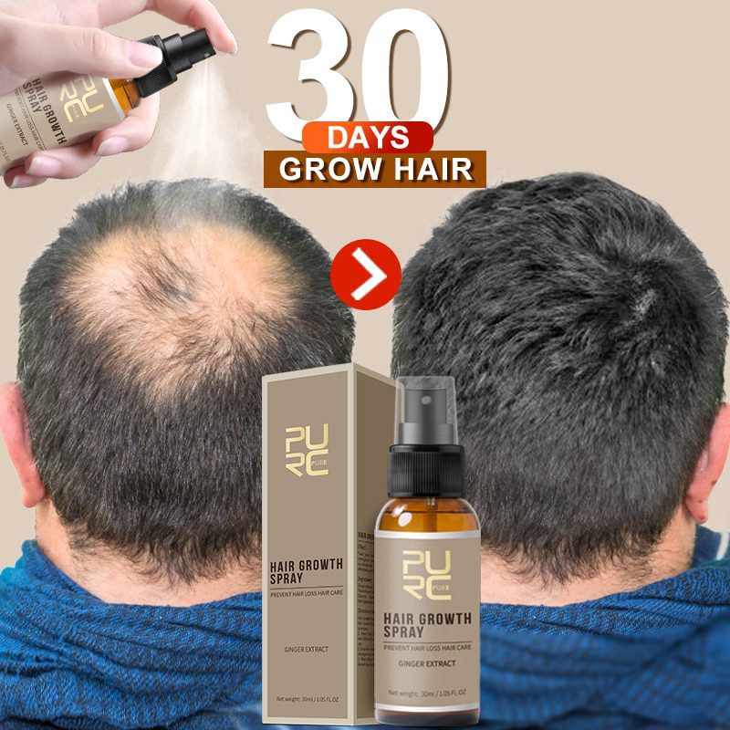 Hair Growth Spray PURC 2019 New Hair Growth Spray Fast Grow Hair hair lossTreatment Preventing Hair Loss 30ml