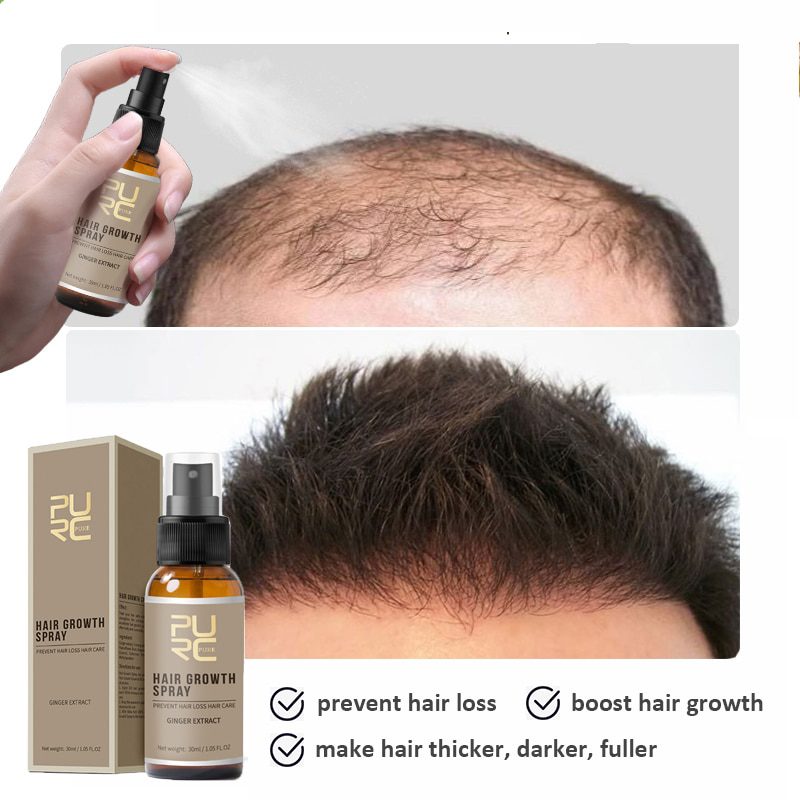 Hair Growth Spray Ginger Hair Nutrition Serum Fast Hair Growth Shampoo Bar Soap Bar Anti Hair Loss Essential Oil 5