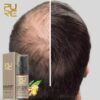 Fast Hair Growth Ginger Essence Oil PURC Hot sale Fast Hair Growth Essence Oil Hair Loss Treatment Help for hair Growth Hair 1