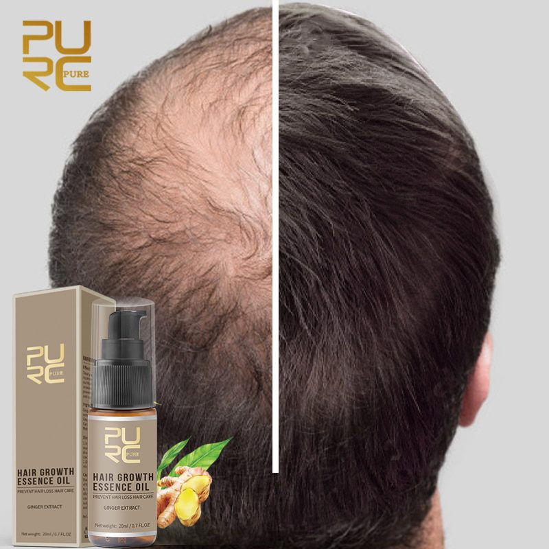Hair Growth Spray PURC Hot sale Fast Hair Growth Essence Oil Hair Loss Treatment Help for hair Growth Hair 1