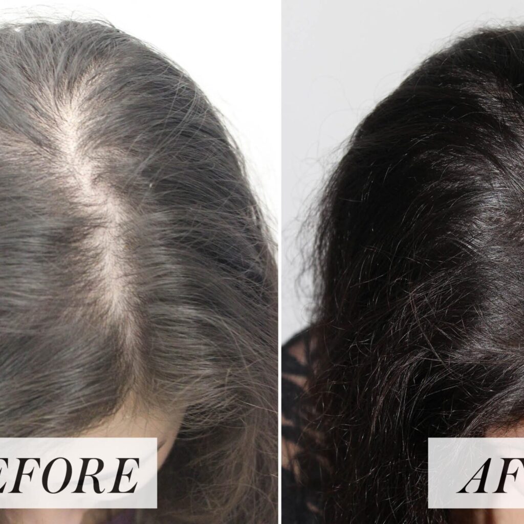 Fast Hair Growth Ginger Essence Oil purcorganics ginger essence oil 2221 scaled e1756189412672