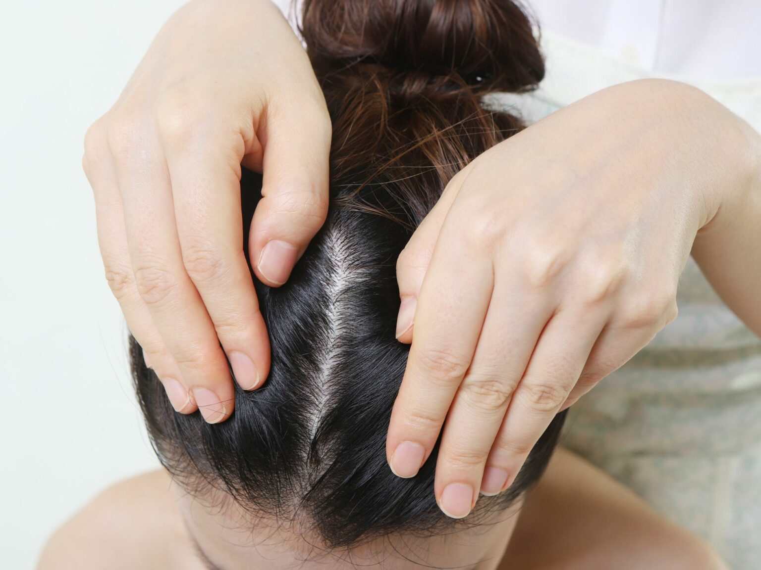 5 Signs Of Scalp Inflammation & How To Heal It PURC Organics