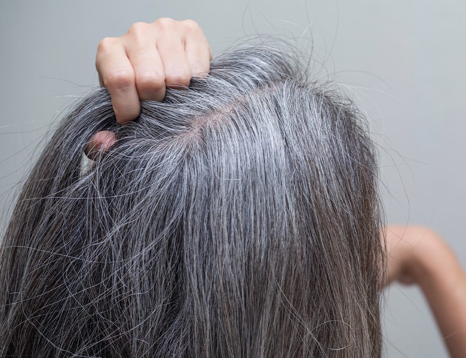 7 Ways To Control Hair Fall This Fall image5
