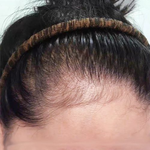 PURC Moroccan Argan Oil Hair Shampoo PURC Intensive Hair Strengthening Treatment Serum 2