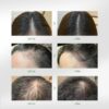 PURC Intensive Hair Strengthening Treatment Serum S0fd35152909e439dae5d2f1e5a5d3af9g