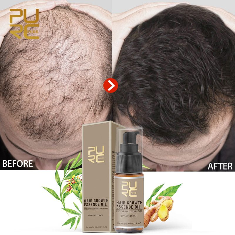 Hair Growth Spray PURC Hot sale Fast Hair Growth Essence Oil Hair Loss Treatment Help for hair Growth Hair