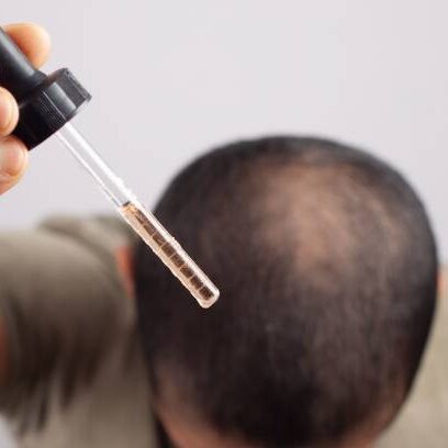 PURC Hair Growth Spray minoxidil 2 e1756290581724