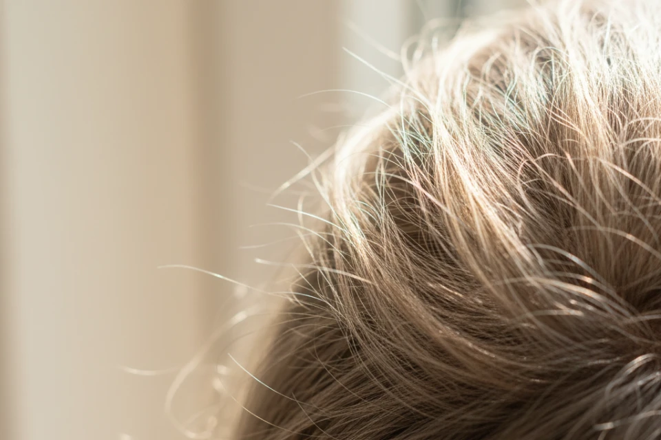 Close-up of frizzy, sun-damaged hair strands catching the light, representing the need for hair repair and healthy hair restoration.